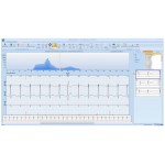 Software Cardio M-Holter