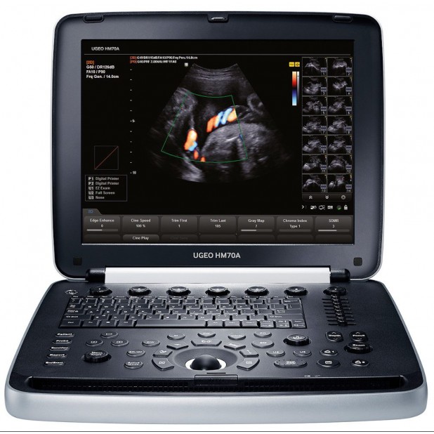 Ecograf portabil Samsung HM70A