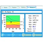 Osteodensitometru cu ultrasunete Inus S (Sonost 3000)